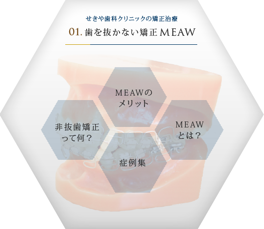 せきや歯科クリニックの矯正治療
            				01.歯を抜かない矯正 MEAW・GEAW