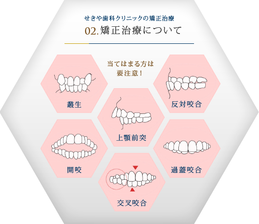 せきや歯科クリニックの矯正治療
            				02.矯正治療について